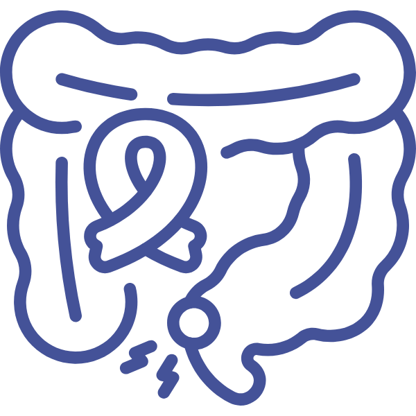 Cáncer de intestino delgado y grueso